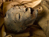 Тутанхамон шкутильгав і помер від малярії