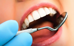 стоматология имплантация зуб