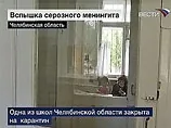 У Росії спалах вірусного менінгіту. Вже захворіли 366 осіб