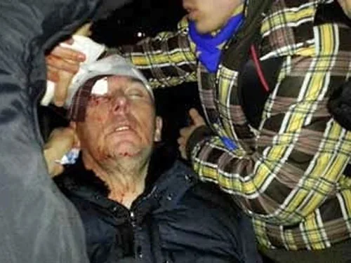 Стан Луценка середньої тяжкості, до нього нікого не пускають