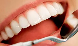 Прайм бонд Dentsply