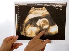 Новый тест позволяет узнать пол будущего ребенка уже на 7-й неделе